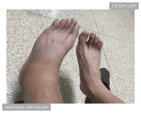 世界冠军腿部严重拉伤